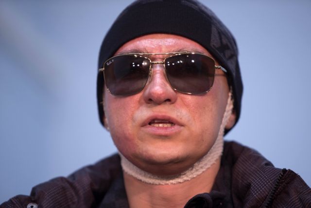 Προσαγωγή υπόπτου για την επίθεση κατά του καλλιτεχνικού διευθυντή των Μπολσόι